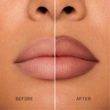 PEPTIDE LIP CONTOUR